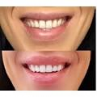 New York Center for Cosmetic Dentistry - 76 Photos & 20 Reviews ...