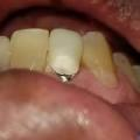 Contemporary Dental Implant Centre - Periodontists - 1825 Barnum ...