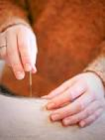 Why Get Acupuncture? - Holden Acupuncture & Chinese Herbal Medicine