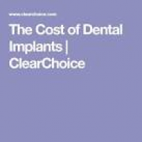 The 25+ best Cost of dental implants ideas on Pinterest | Teeth ...