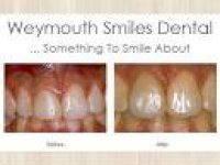 10 best Best Dentist in Weymouth, MA images on Pinterest ...
